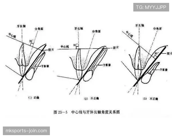 门线技术判罚规则详解及其在关键进球认定中的应用